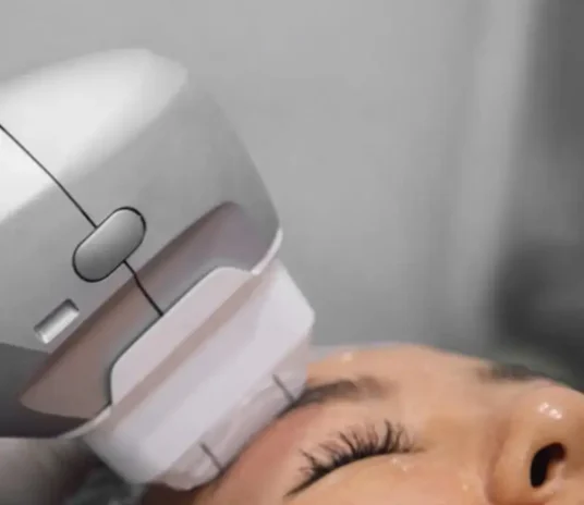 hifu-treament-novelage-image-02