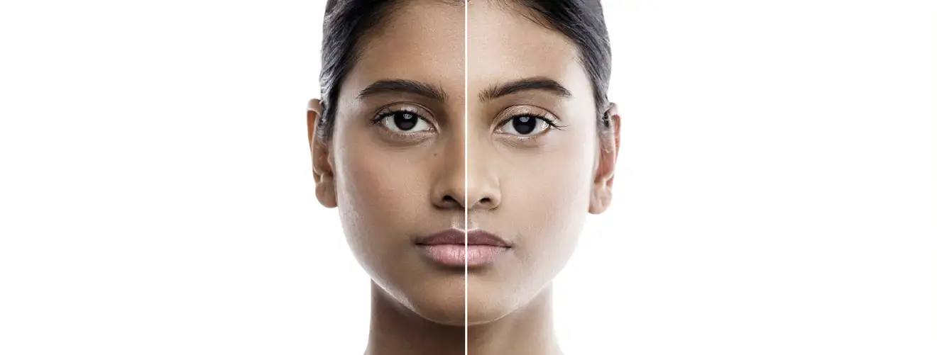 tan-removel-treatment-novelage-services-image-03