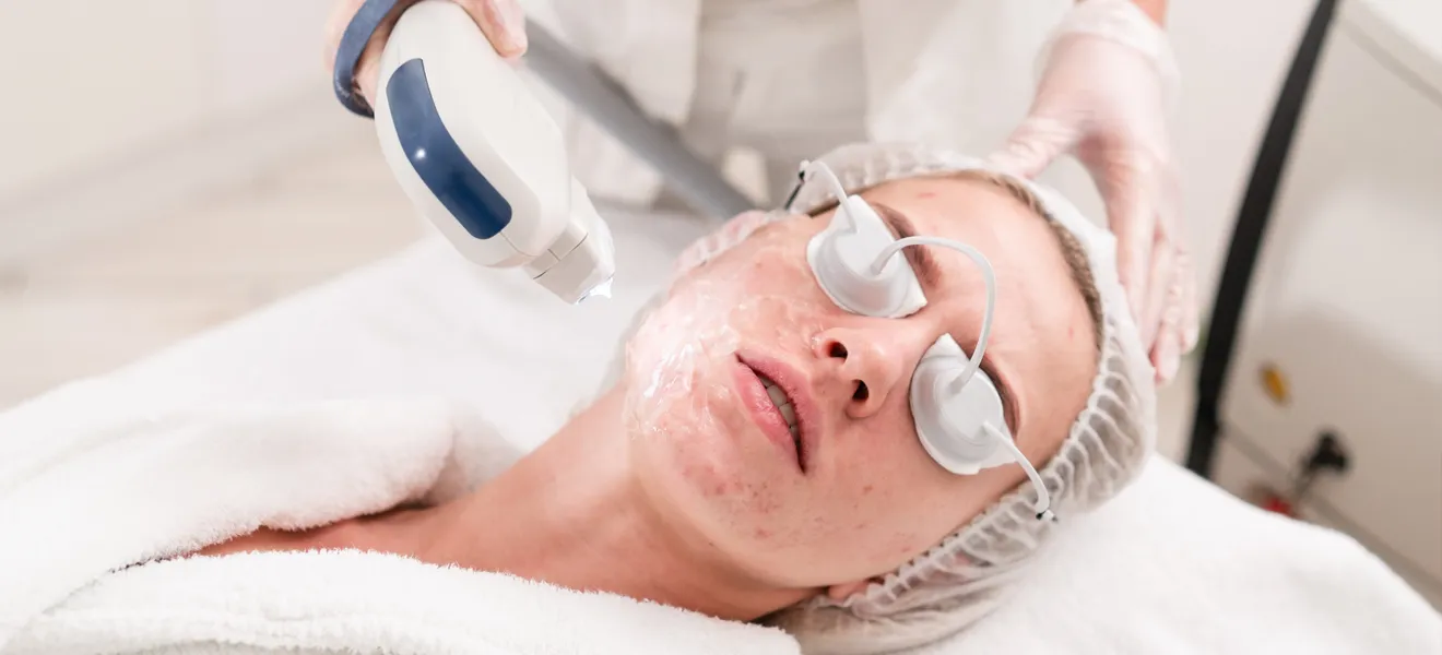 Acne-treatment-novelage-services-image-01