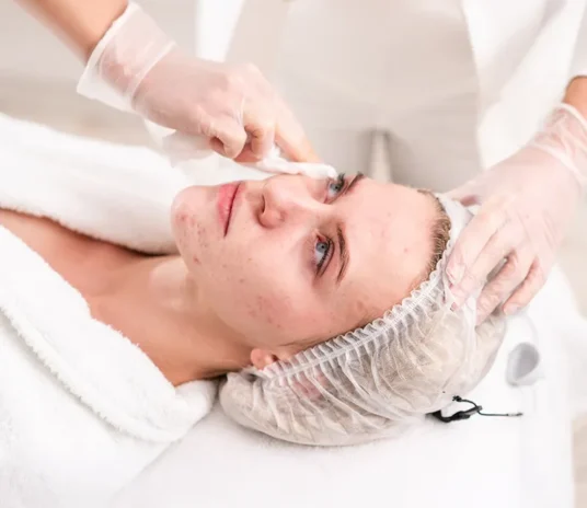 novelage-acne-treatment-image-01