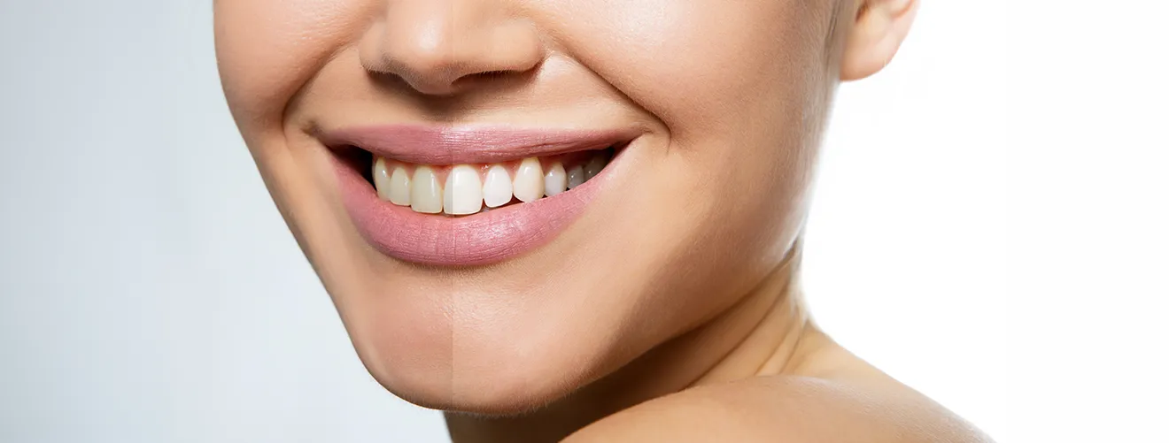 skin-before-after-image-white-novelage