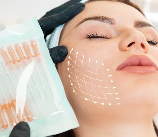 thread-lift-image-01-image-01